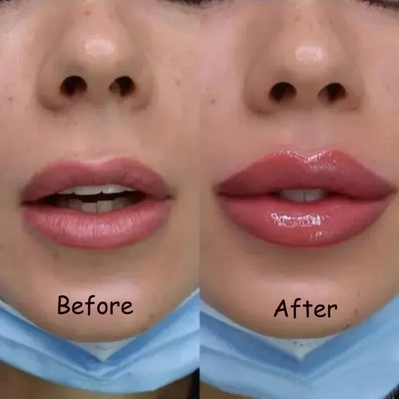 Lip Plump Serum – Moisturizing & Volumizing Lip Oil
